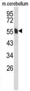 AP52741PU-N - MPP6