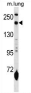 AP52743PU-N - CD206 / MRC1