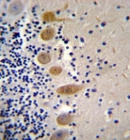 AP52761PU-N - Macrophage stimulatory protein