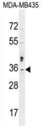 AP52772PU-N - Metaxin-2