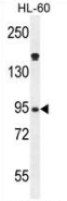 AP52788PU-N - Myeloperoxidase