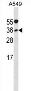 AP52789PU-N - Myogenic factor 5 (MYF5)
