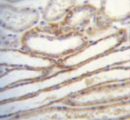 AP52796PU-N - Myosin-IIIB