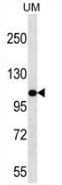 AP52796PU-N - Myosin-IIIB