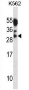 AP52800PU-N - Myogenin