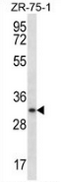 AP52801PU-N - Myogenin