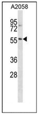 AP52805PU-N - NACC2 / BTBD14A