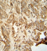 AP52814PU-N - NAT14