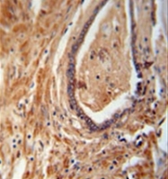 AP52838PU-N - NDUFAF1