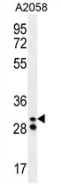 AP52858PU-N - Neutrophil elastase