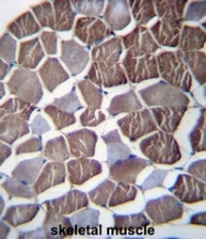 AP52918PU-N - Nephrocystin 3