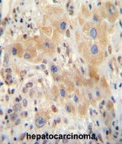 AP52928PU-N - NR0B2