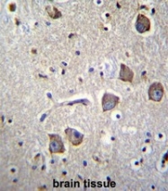 AP52938PU-N - NRN1L