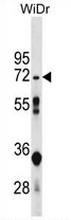 AP52948PU-N - NT5C2