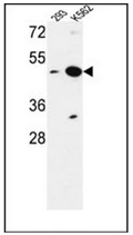 AP52975PU-N - NUPL2