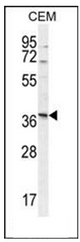 AP52980PU-N - Neurexophilin-4