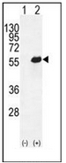 AP52999PU-N - Osteopontin / SPP1