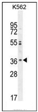 AP53034PU-N - Olfactory receptor 2M3