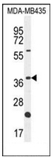 AP53100PU-N - Olfactory receptor 6V1