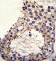 AP53126PU-N - Otoancorin / OTOA