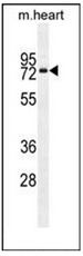 AP53128PU-N - Otopetrin-1