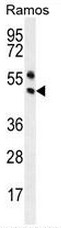 AP53179PU-N - PAX5