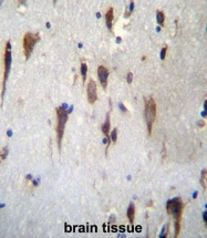 AP53196PU-N - PCDH7