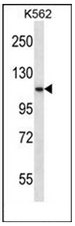 AP53222PU-N - PCSK6 / PACE4