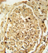 AP53242PU-N - PDHA2