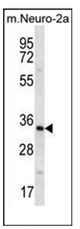 AP53260PU-N - Peroxin 14 / PEX14
