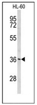 AP53261PU-N - Peroxin 14 / PEX14