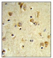 AP53261PU-N - Peroxin 14 / PEX14