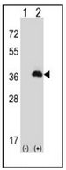 AP53262PU-N - Peroxin 16 / PEX16