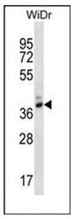 AP53267PU-N - Pepsin