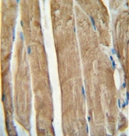 AP53269PU-N - PGAM2