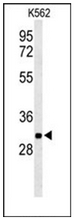 AP53271PU-N - PGP / Phosphoglycolate phosphatase