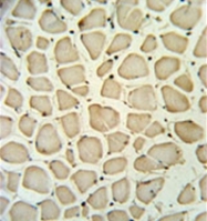 AP53271PU-N - PGP / Phosphoglycolate phosphatase