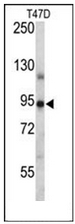 AP53273PU-N - Progesterone receptor