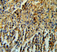 AP53291PU-N - PPP1R18 / Phostensin