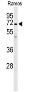 AP53291PU-N - PPP1R18 / Phostensin