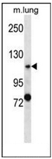 AP53314PU-N - PKD2