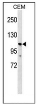 AP53315PU-N - PKD2L1