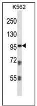 AP53319PU-N - Plakophilin-2