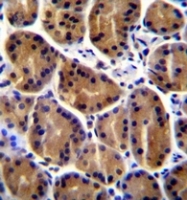 AP53319PU-N - Plakophilin-2
