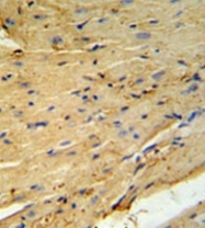 AP53332PU-N - Phospholamban