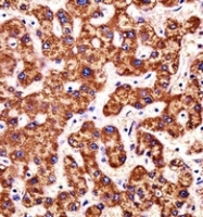 AP53344PU-N - PLD2