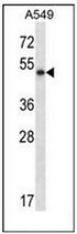 AP53366PU-N - Pancreatic lipase / PNLIP