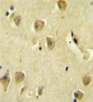 AP53404PU-N - PPP1R14C