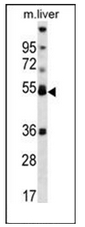 AP53407PU-N - PPAR-alpha