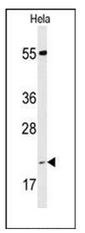 AP53410PU-N - Cyclophilin C